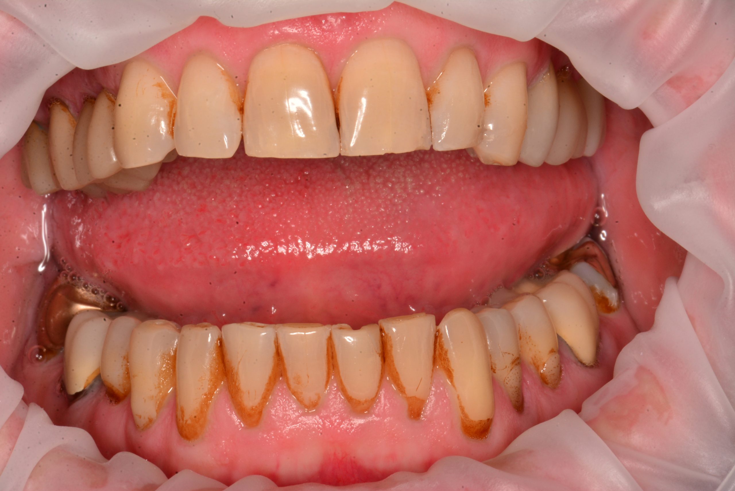 Hygiene before photo